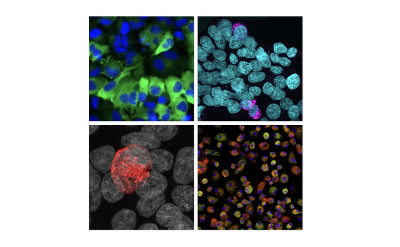 Home | Stowers Institute for Medical Research