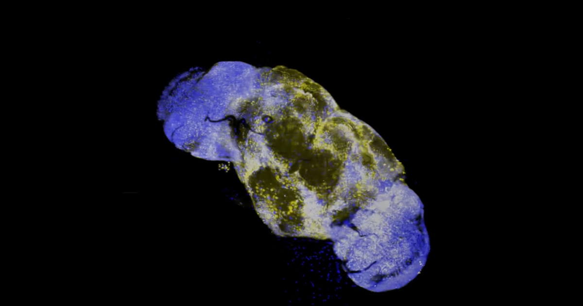 Stowers Ras New research reveals how the… | Stowers Institute for Medical Research