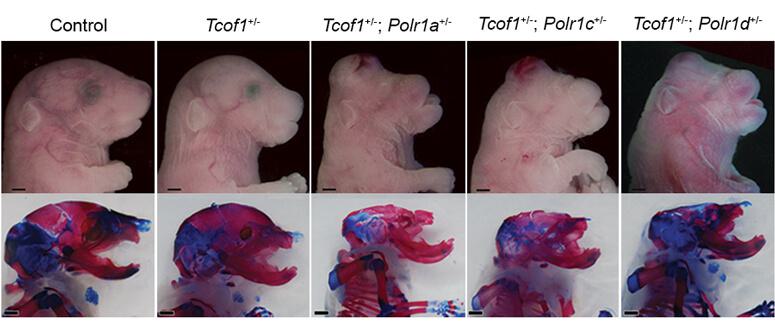 Mouse embryos at 18.5 days post-fertilization. Combinations of mutations in the RNA Polymerase I genes and associated gene factor Tcof1 increase the severity of craniofacial anomalies.