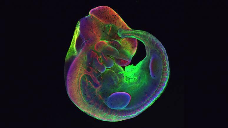 Fluorescent microscopy image of a mouse embryo. Red staining indicates peripheral neurons and nerves derived from neural crest cells.