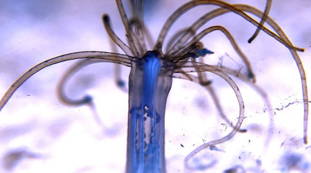 A jellyfish up close