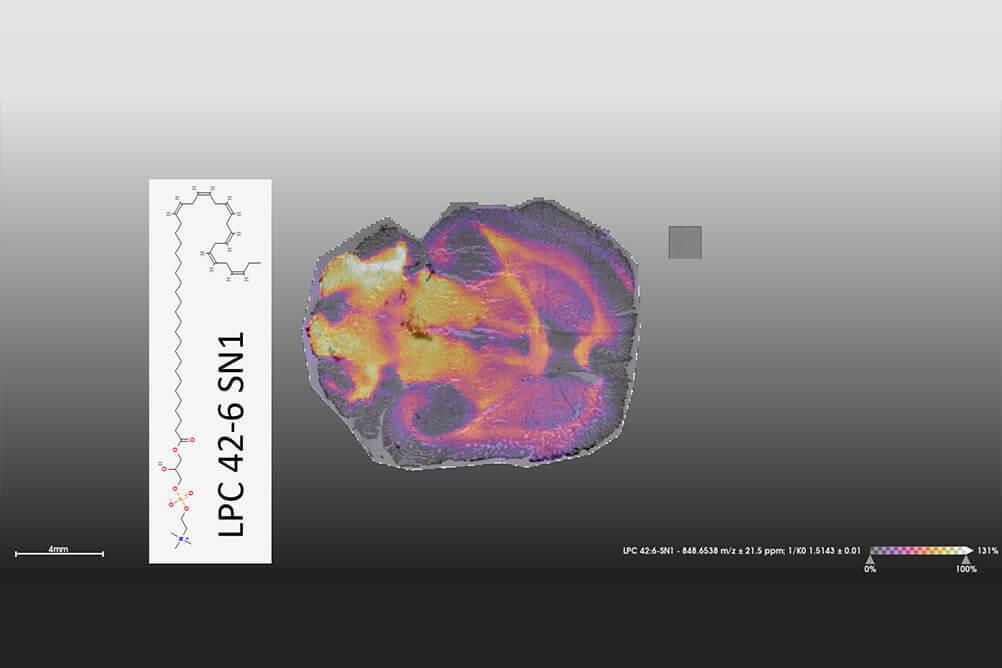 Image of rat brain depicting distribution of Lysophosphatidylcholine 42:6 and image of molecular structure of Lysophosphatidylcholine 42:6.