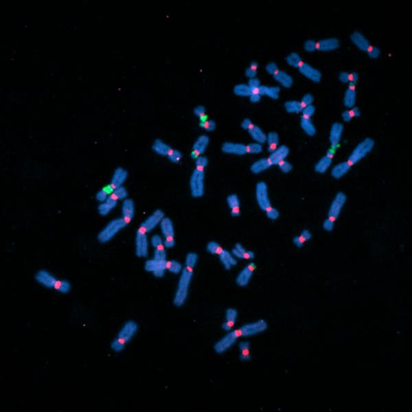Microscopic image of fluorescently labeled human chromosomes showing attachment points called centromeres and regions of ribosomal DNA.